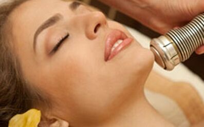 Πλεονεκτήματα και μειονεκτήματα της fractional λέιζερ αναζωογόνησης δέρματος